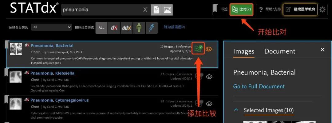 手把手教程：美国医生广泛好评的影像学工具STATdx用户指南 - 知乎