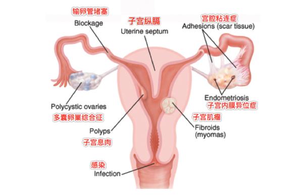 自然流产是优胜劣汰的结果 再备孕 要积极 知乎