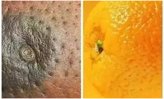 乳晕颜色和性有关系吗