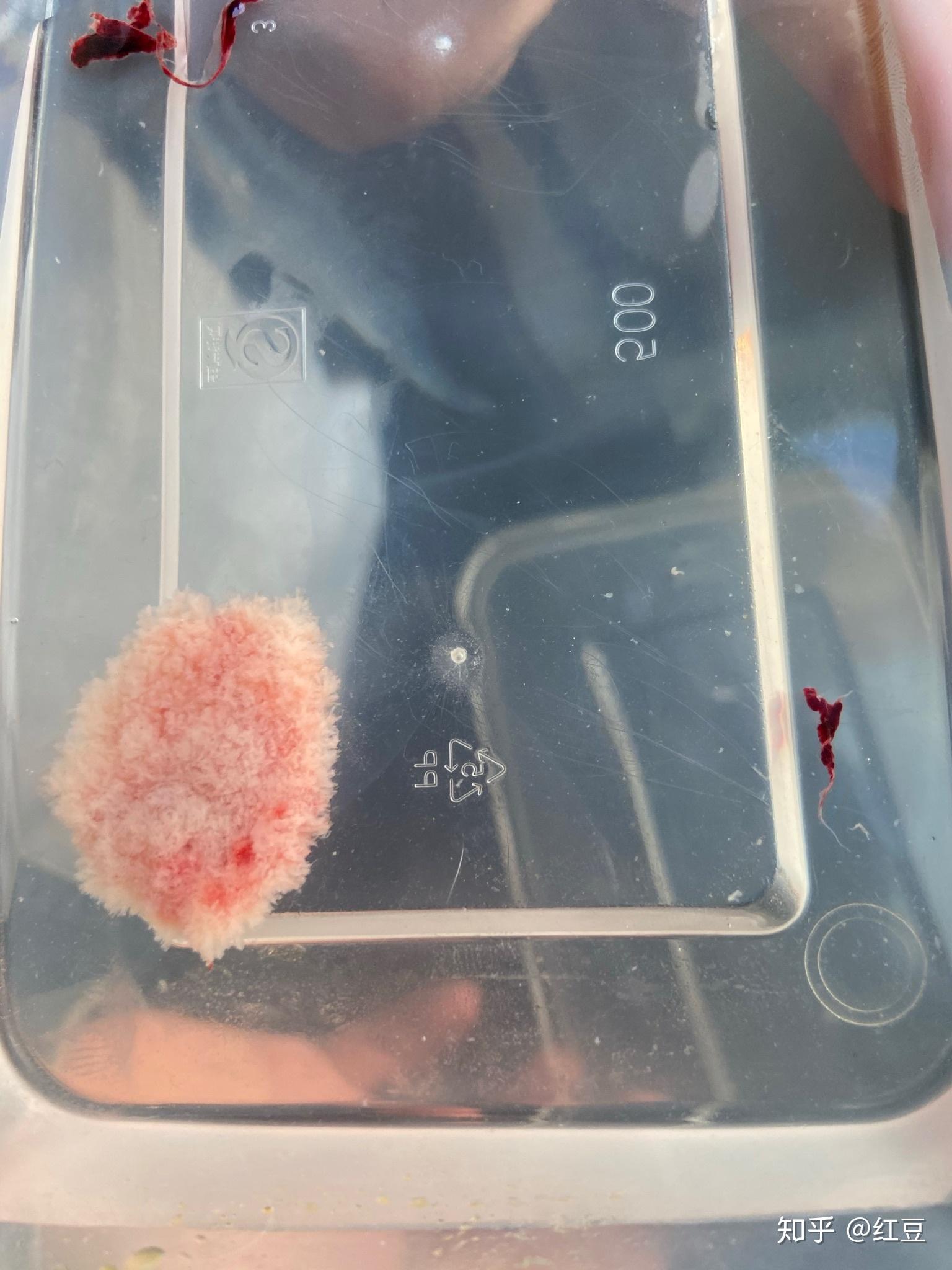 药物流产从开始到结束半个月