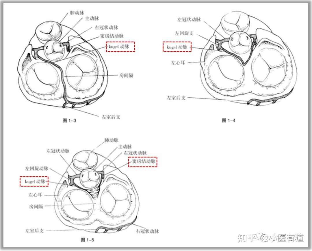 【心脏解剖】冠状动脉——左回旋支