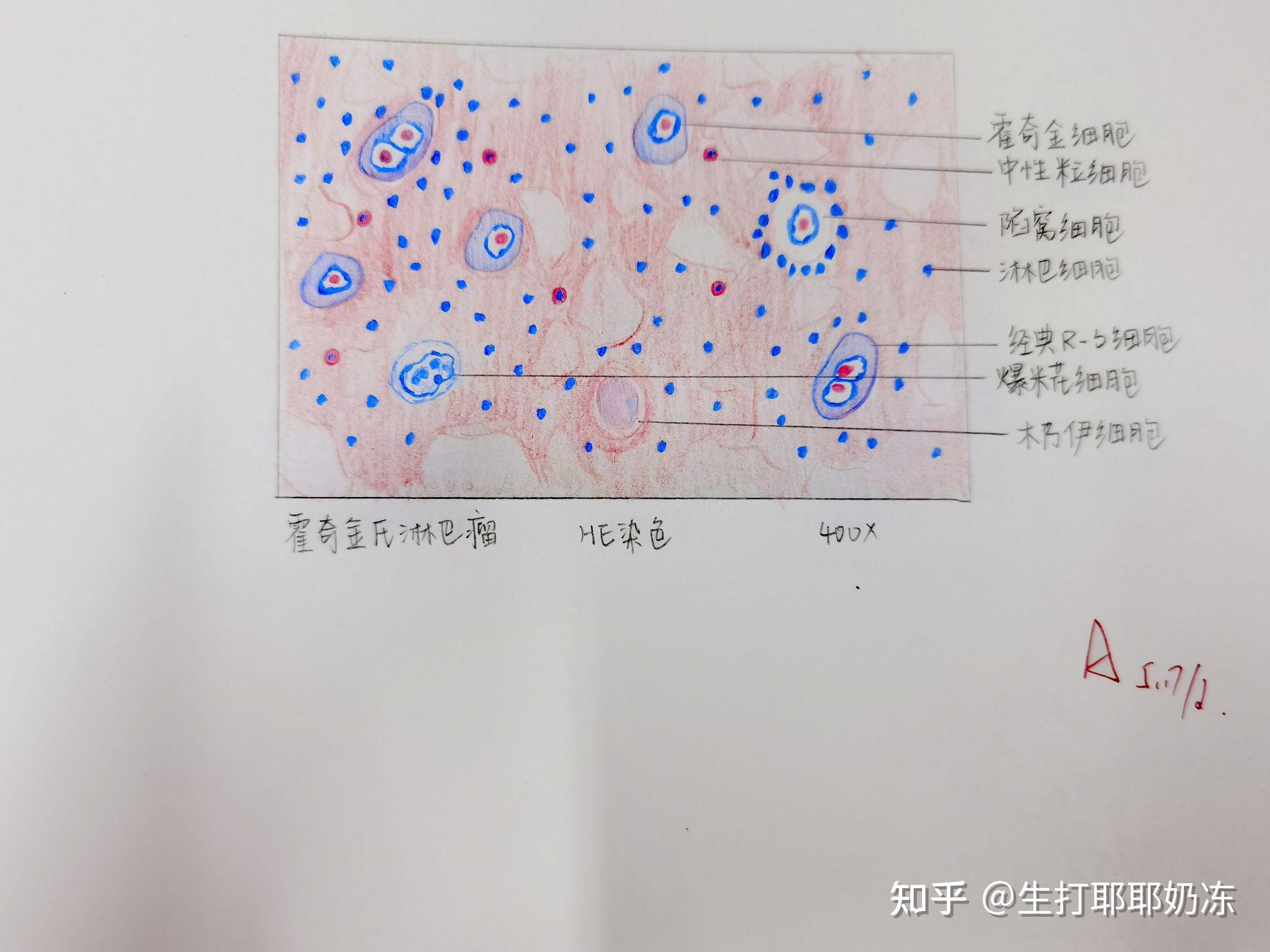 病理红蓝铅笔绘图