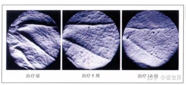 护肤保养到底有用没_如何护肤保养_普通gsm机子用联通3g卡 有漫游没
