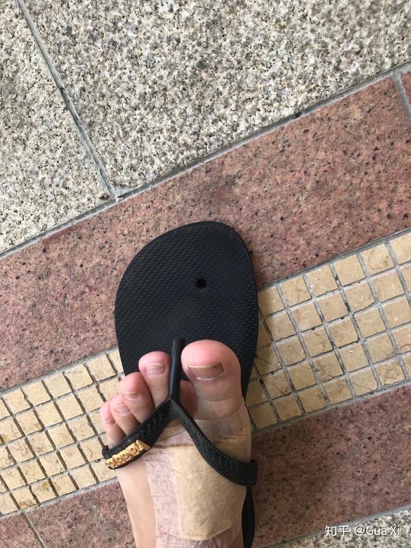 论在大街上人字拖突然坏了是一种什么样的体验