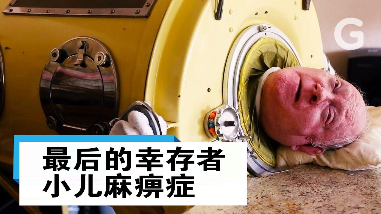 最后的小儿麻痹症幸存者最后的铁肺