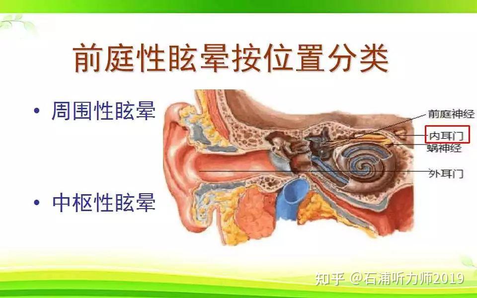 如何区分“耳石症”与“颈性眩晕”? - 知乎