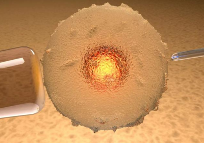 在国内冷冻卵子先看自己有没有符合条件