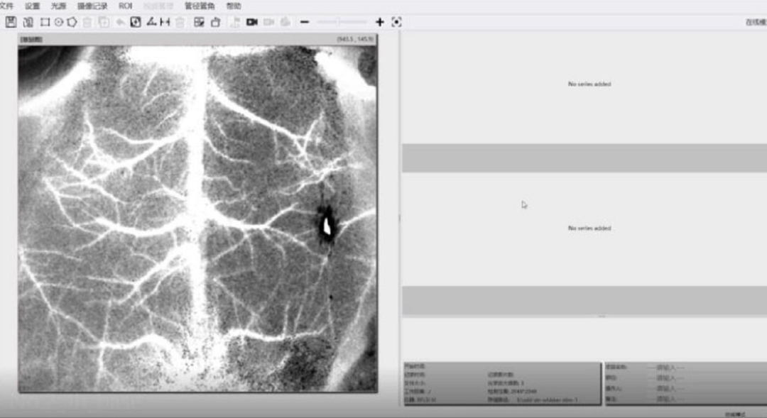 真实案例：散斑用户的使用感受分享 - 知乎