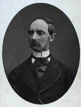 植发有害吗,为什么威廉王子脱发挺厉害的,却没