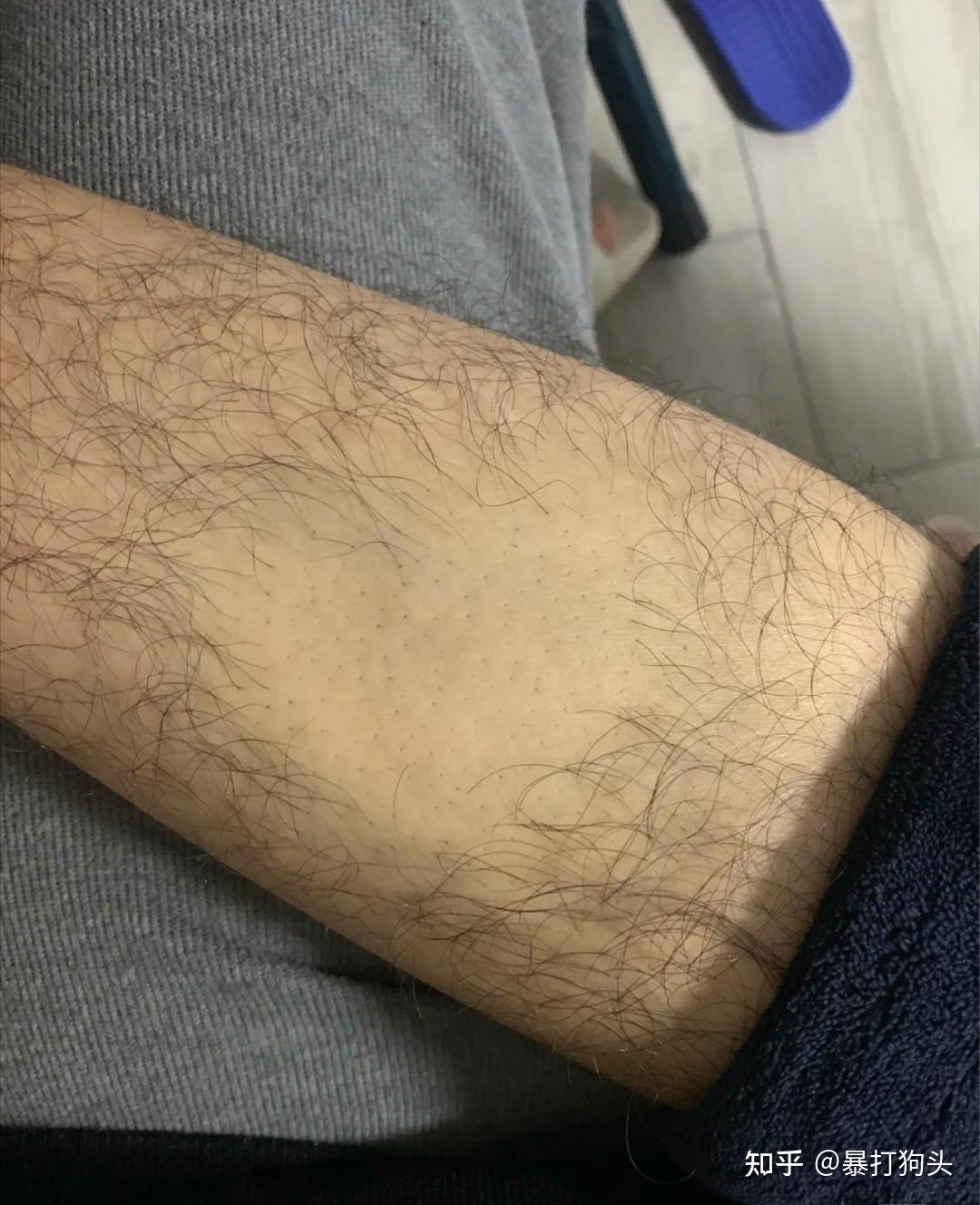 有没有男女都适用的靠谱的脱毛膏?