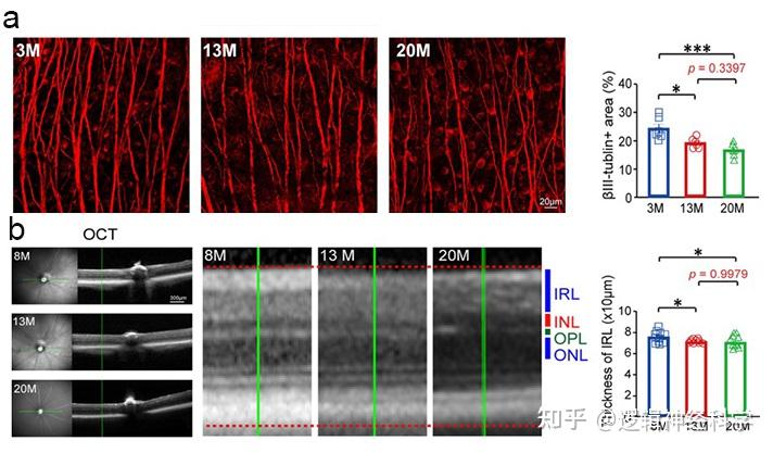 Mieri Rgc J Neurosci︱梅峰/叶剑课题组揭示老化过程中少突胶质细胞更替不足是导致视神经轴突退化和视功能下降的重要原因 - 知乎