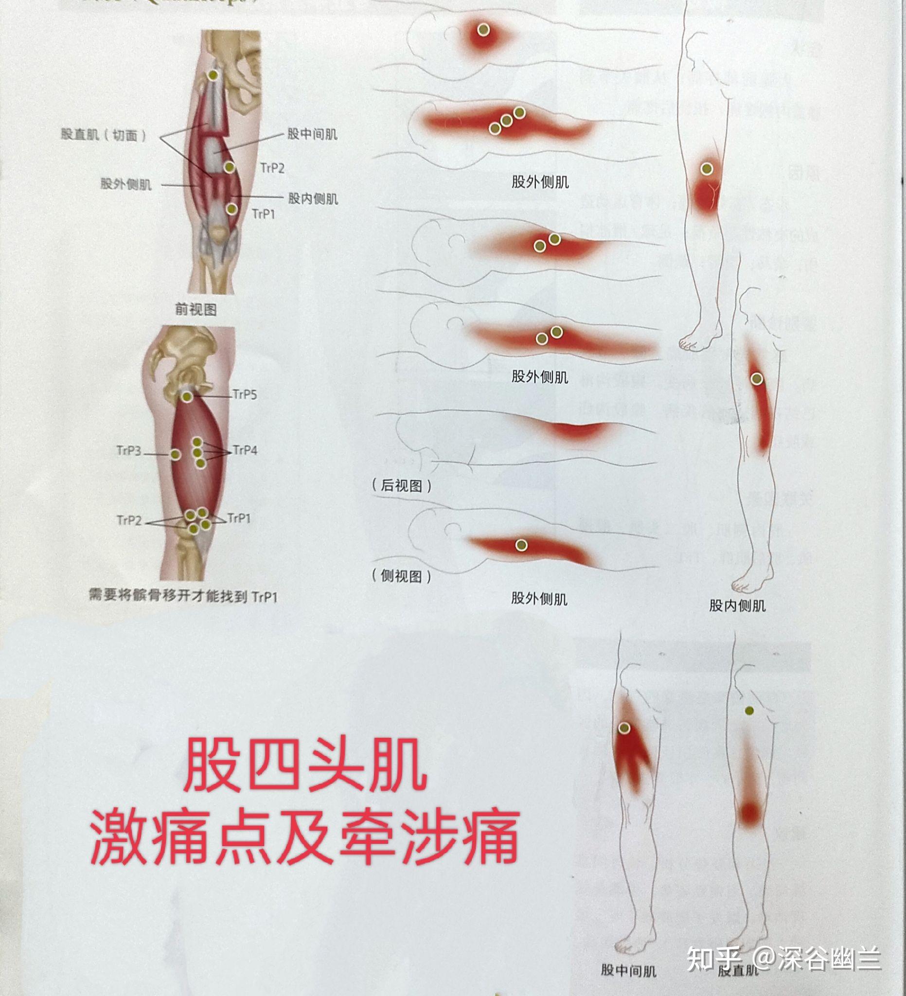 膝盖前侧疼痛有关激痛点及穴位