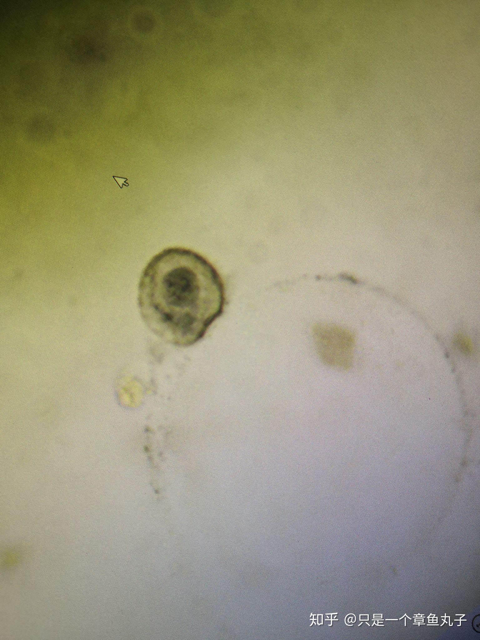 寄生虫部分显微镜下图 - 知乎
