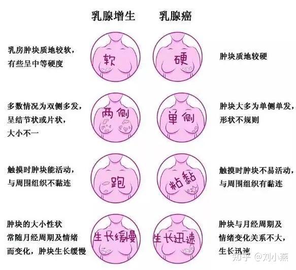 乳头溢液在妇女非哺乳期间,发生乳头溢液多属病理性,最常见的病因是