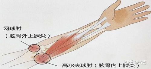 只有十分鐘我的網球肘就不疼了