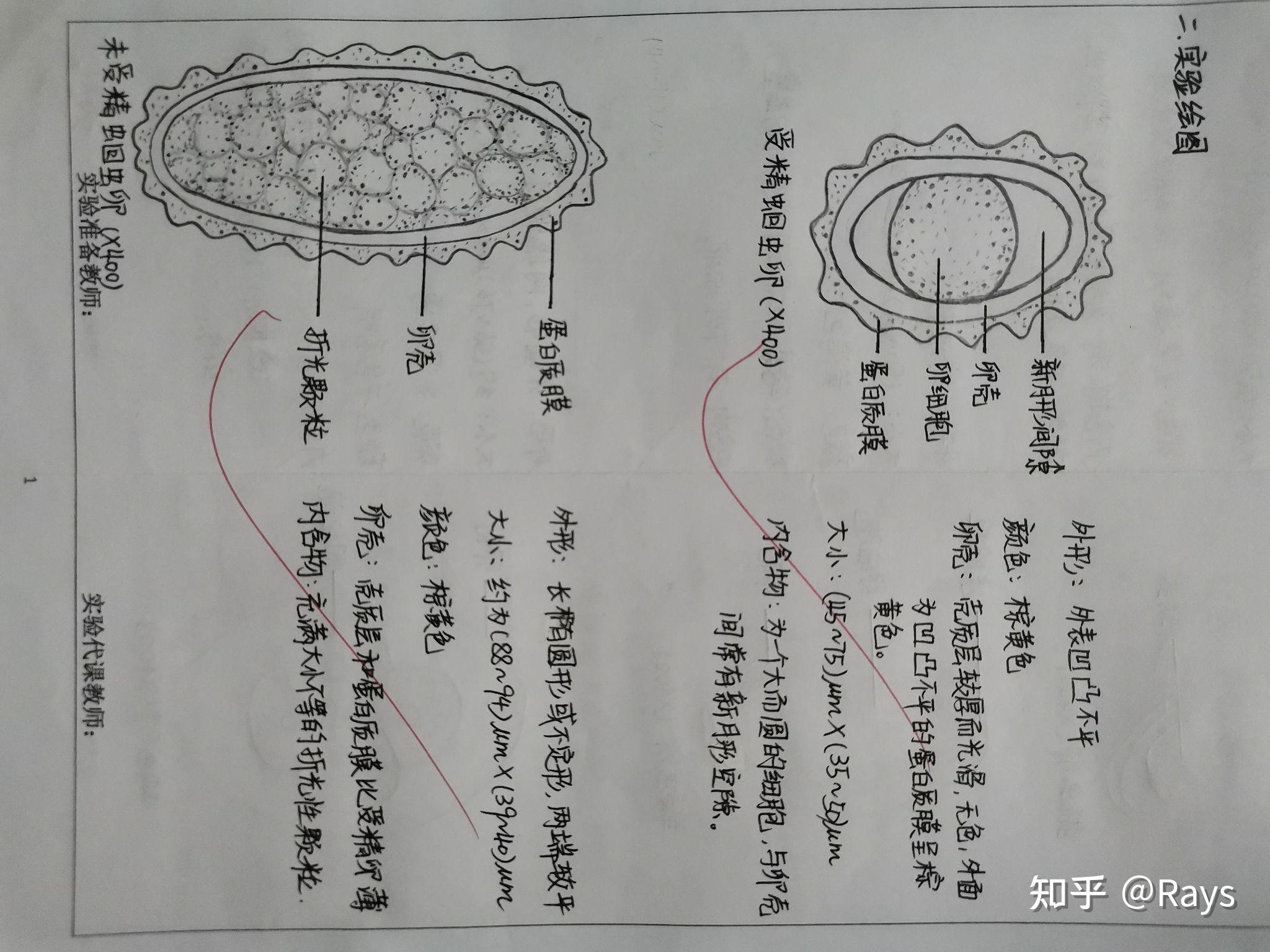 日本血吸虫卵手绘图片