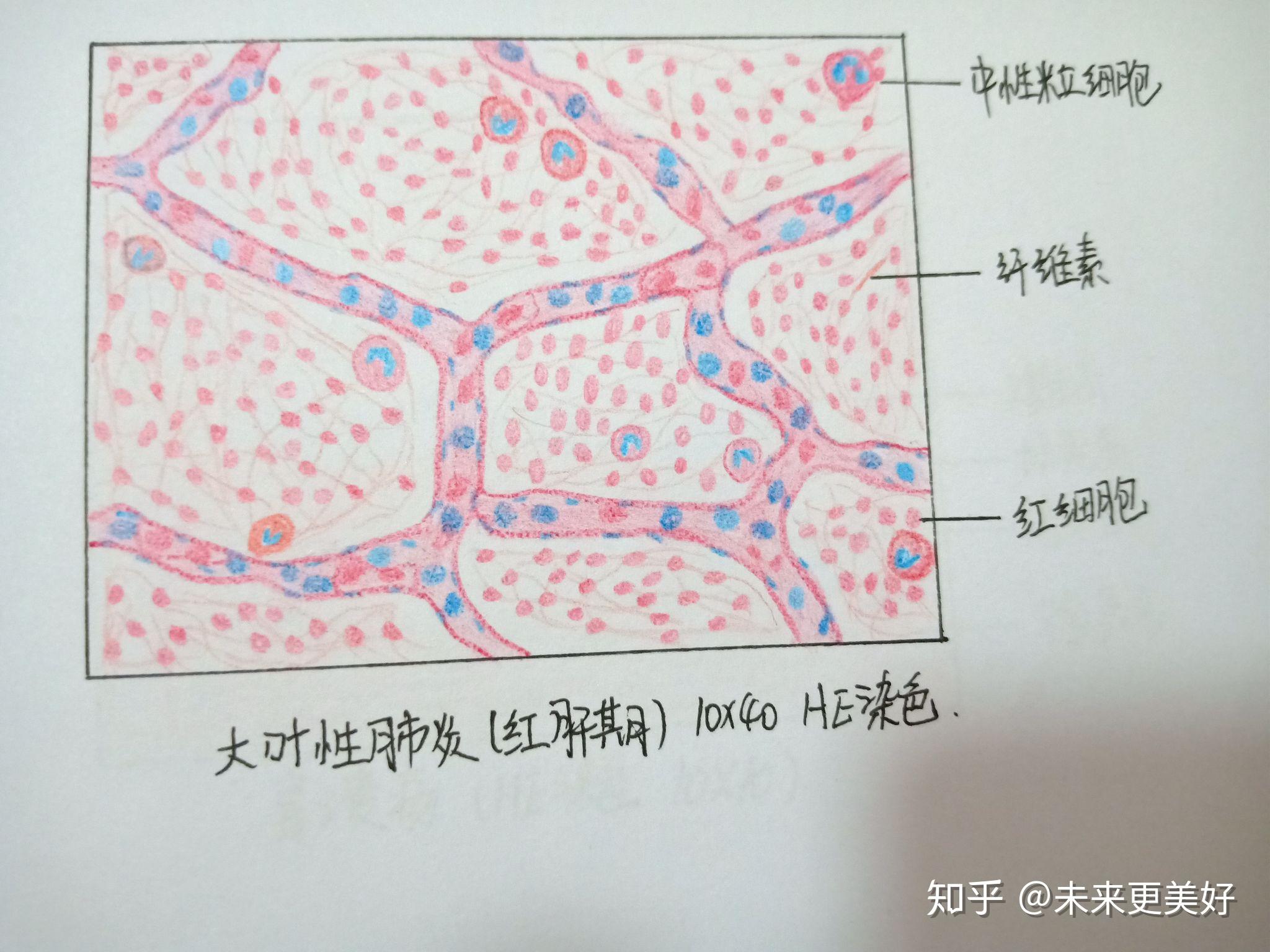 病理学切片红蓝铅笔手绘图