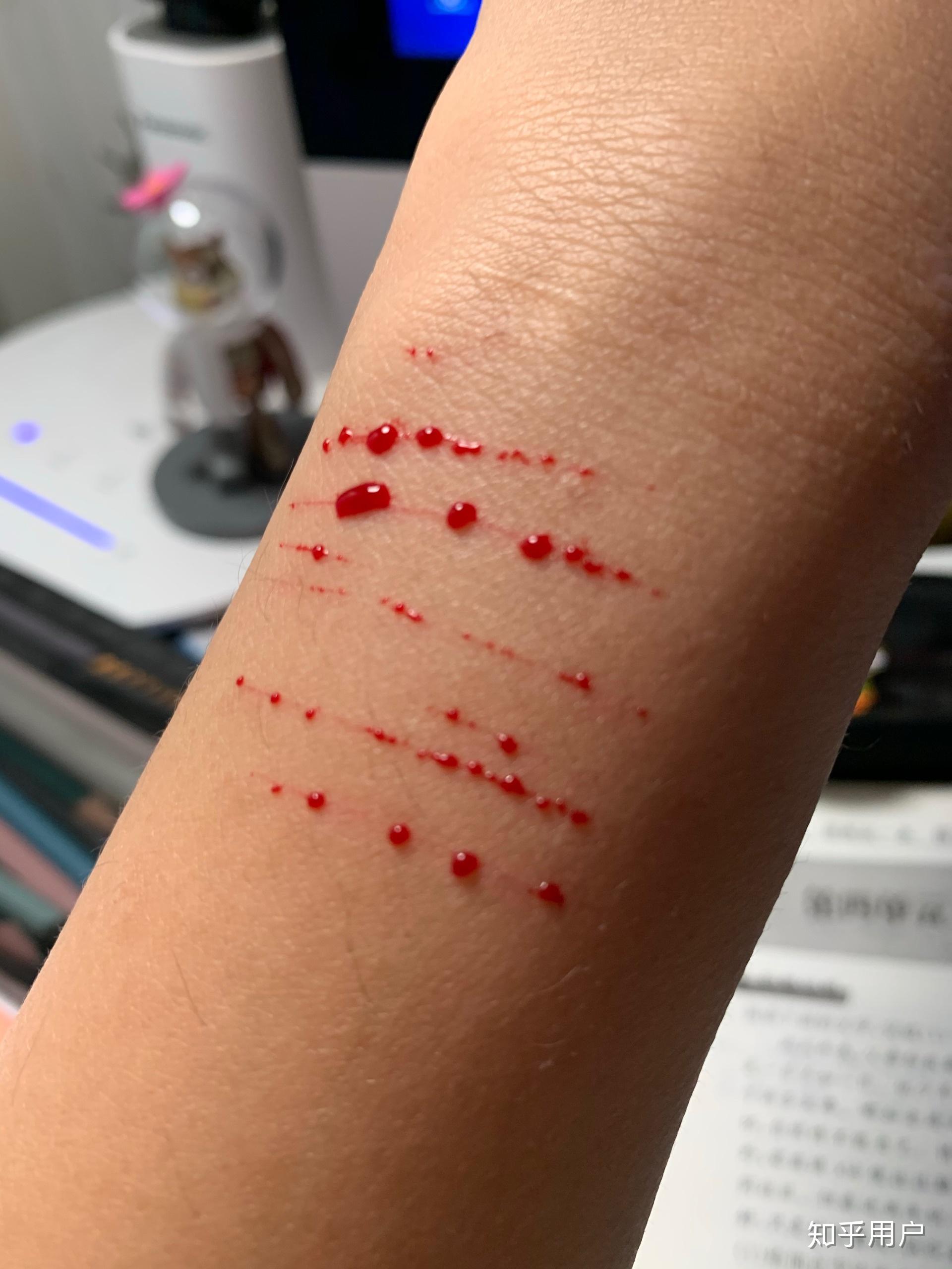 自残属于什么心理