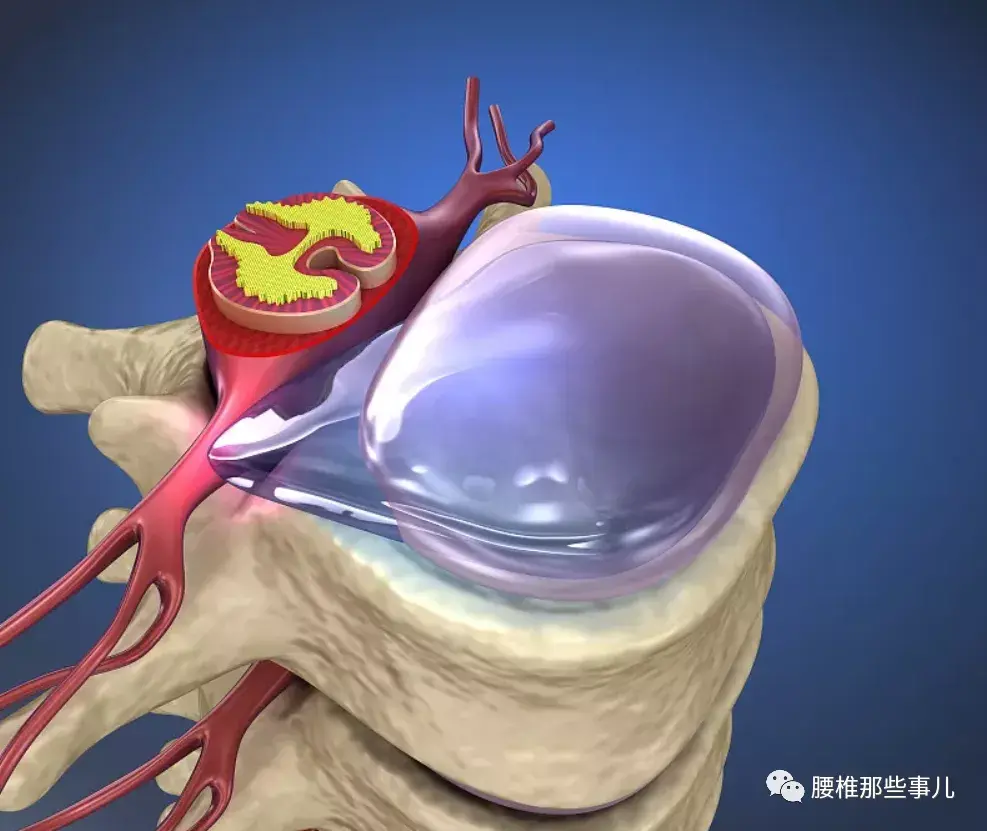 我们先来了解下什么是椎管!