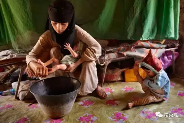 于联合国儿童基金会公布的相片)阿富汗,40岁的 faiz 与他11岁的新娘