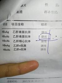 肝功能檢查怎麼看乙肝兩對半透漏哪些秘密看懂乙肝檢查報告