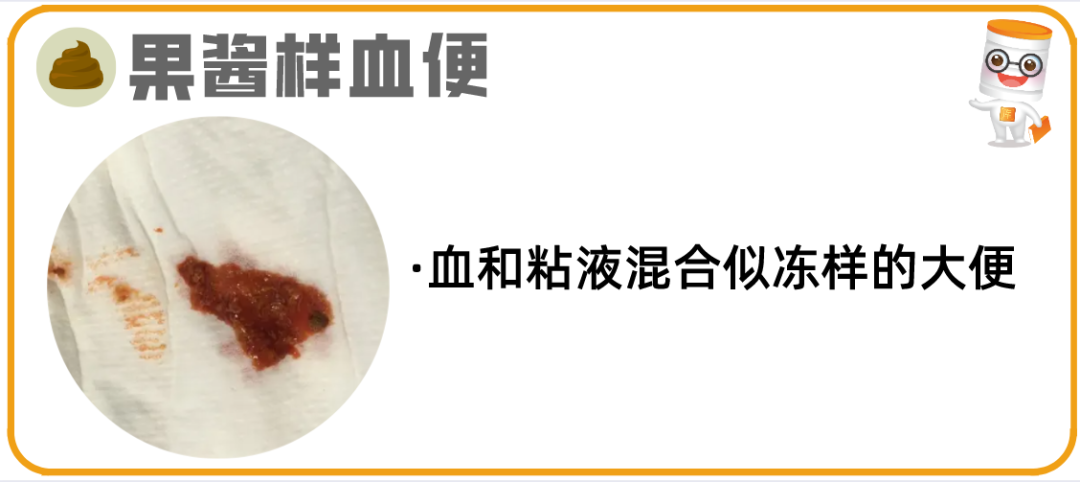 逾20种宝宝大便图片详解!最后10种必须警惕! - 知乎
