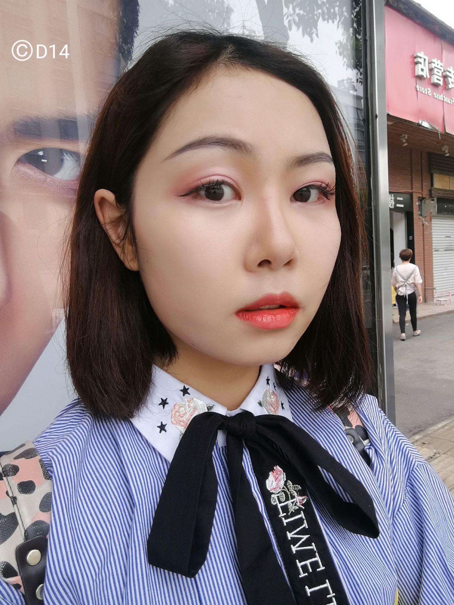 光纤溶脂,面部吸脂,瘦脸针,请做过的女生来,不要