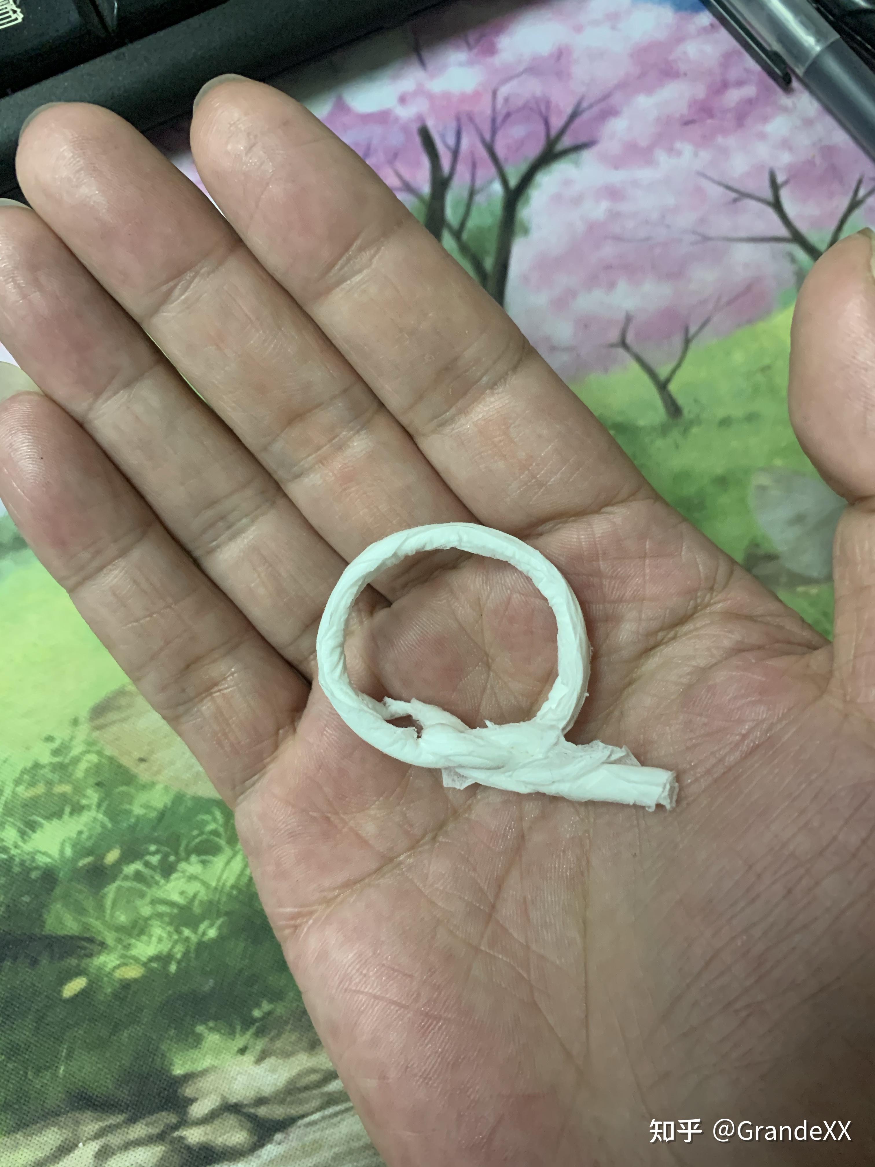 复阻环是否真的能解决包皮过长问题? - 知乎