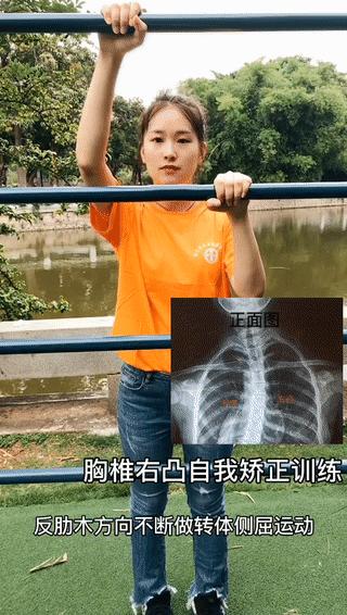 教你八个动作自我矫正脊柱侧弯