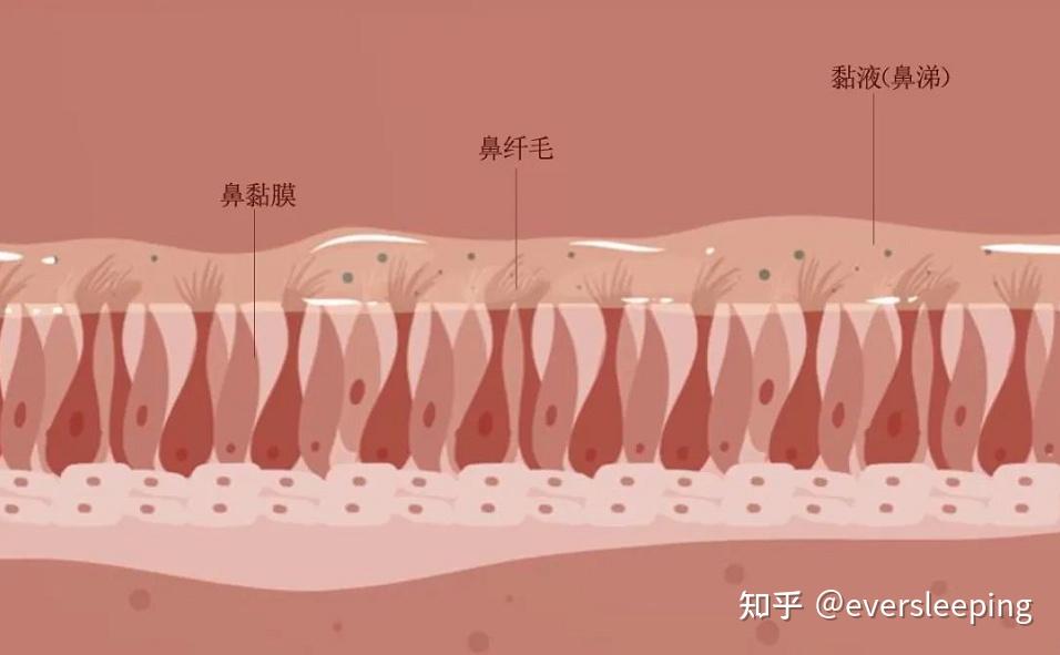 鼻粘膜水肿怎才能消除图片