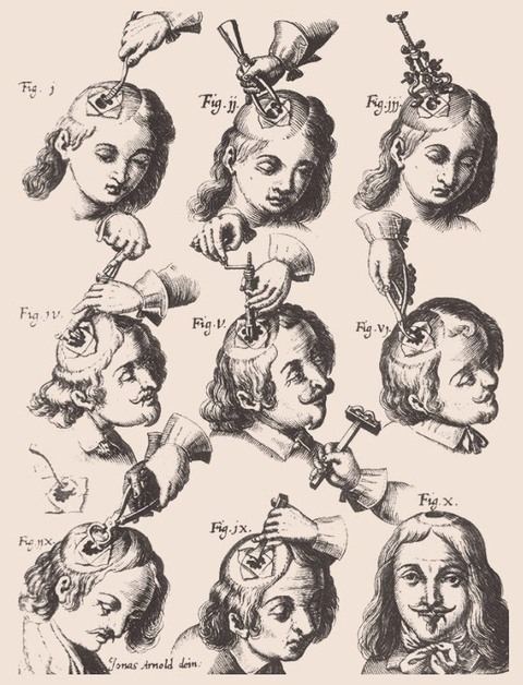 挖脑子的技术一步步