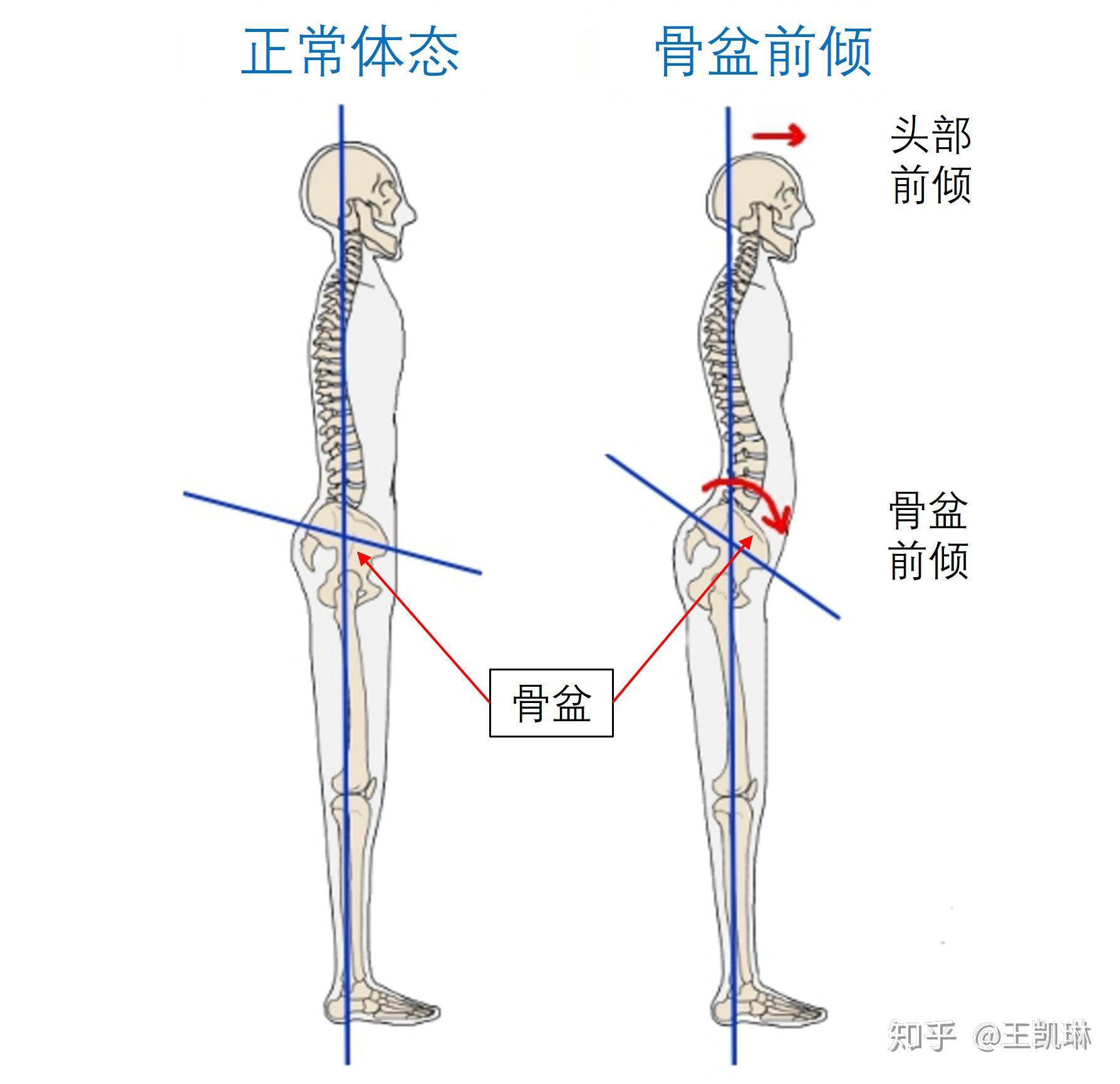 【形象管理】4个拉伸动作改善大腿前凸僵紧 - 知乎