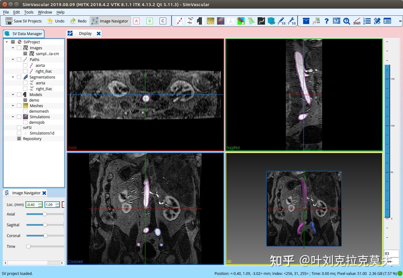开源科学工程技术软件介绍 – 血流模拟和分析软件Simvascular - 知乎