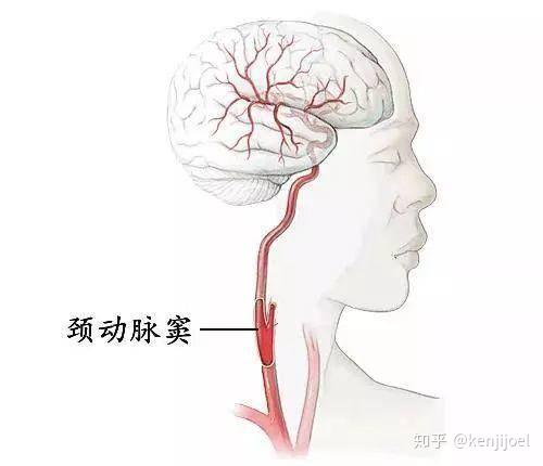 颈部保养_颈部保养常识_颈部保养护肤