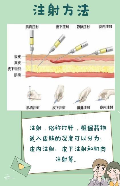 关于注射你了解么 - 知乎