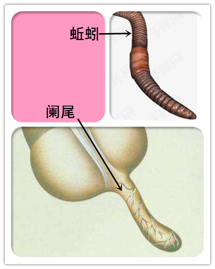 阑尾炎是怎么得的 v2-4b646087df63d193395e89b6295c9553_r.jpg