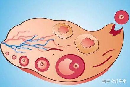 一個月內月經來了兩次看完這三個原因你就明白了