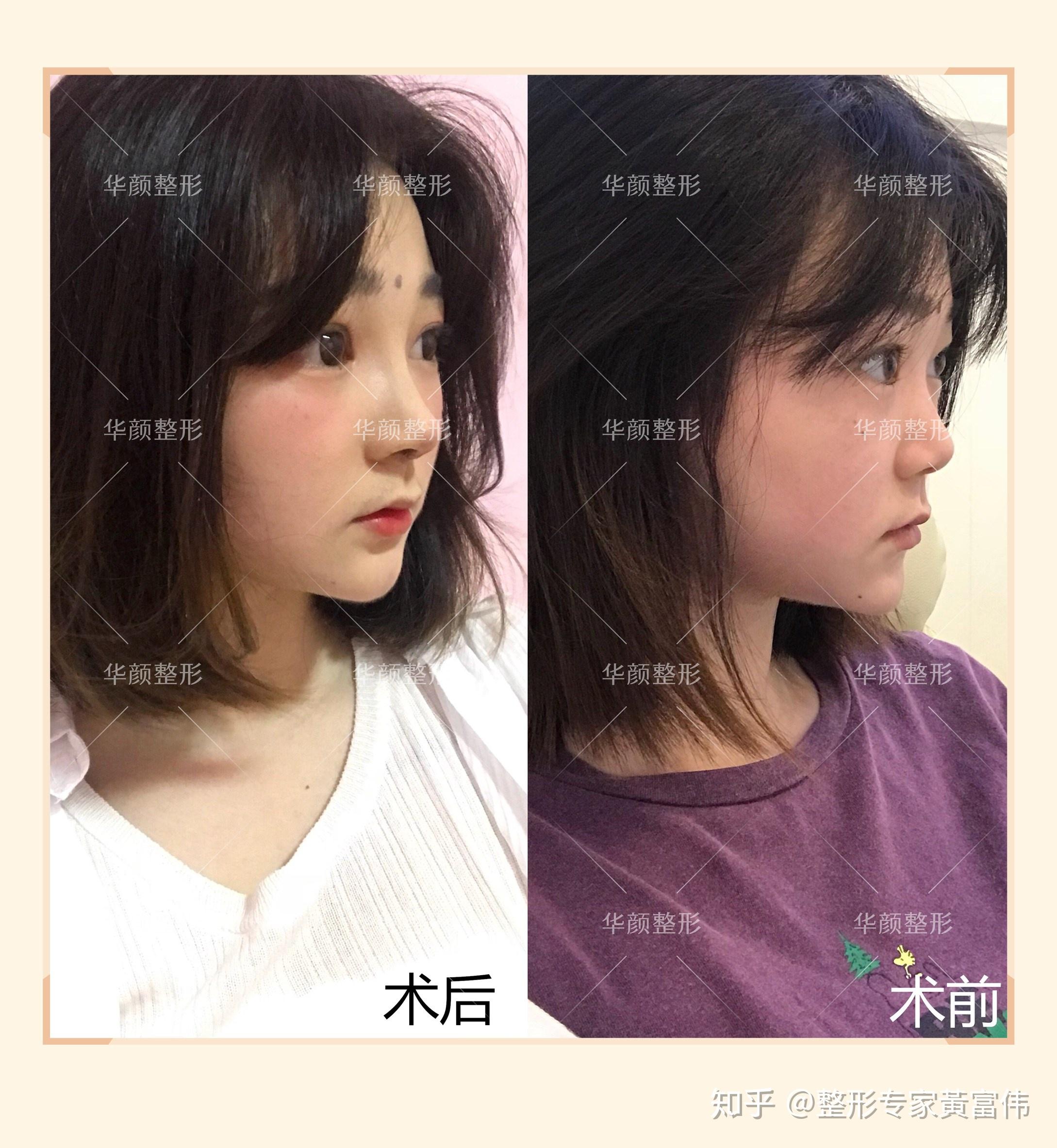 东北往事之黑道风云20年全集