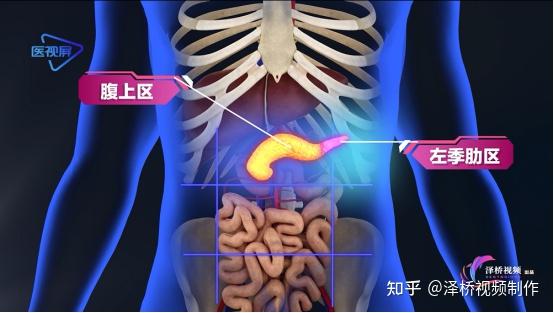 胰腺毗邻器官位置图图片