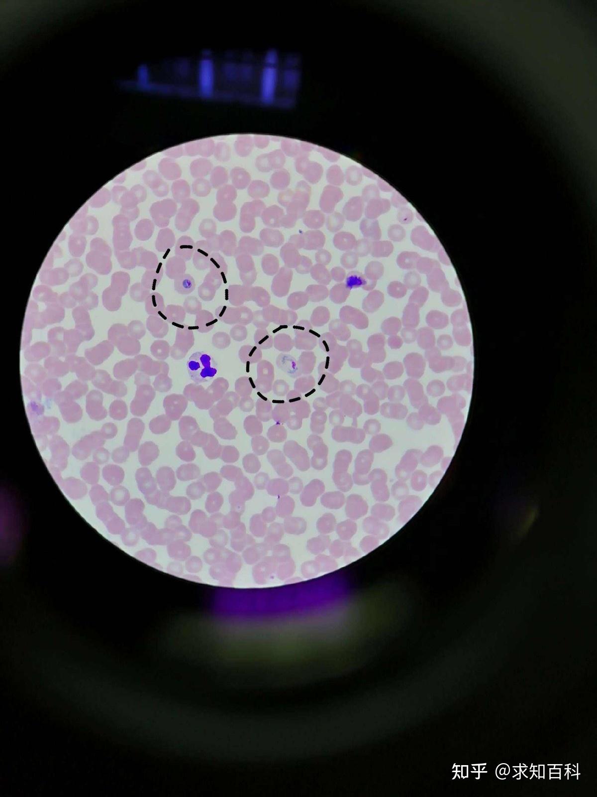 当捕猎者发现自己体内养着红藻,同时拥有了光合作用后,不用再辛苦地