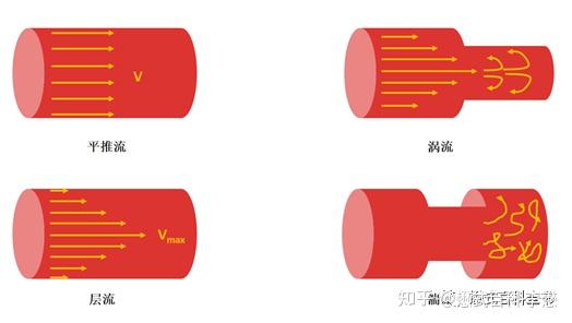 磁共振血管成像技术概述:血流信号的特点 - 知乎