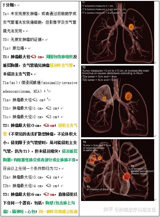 2021版肺癌分期和分类图片