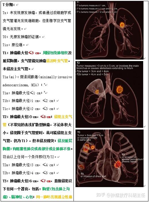 肺癌tnm分期第9版图解图片