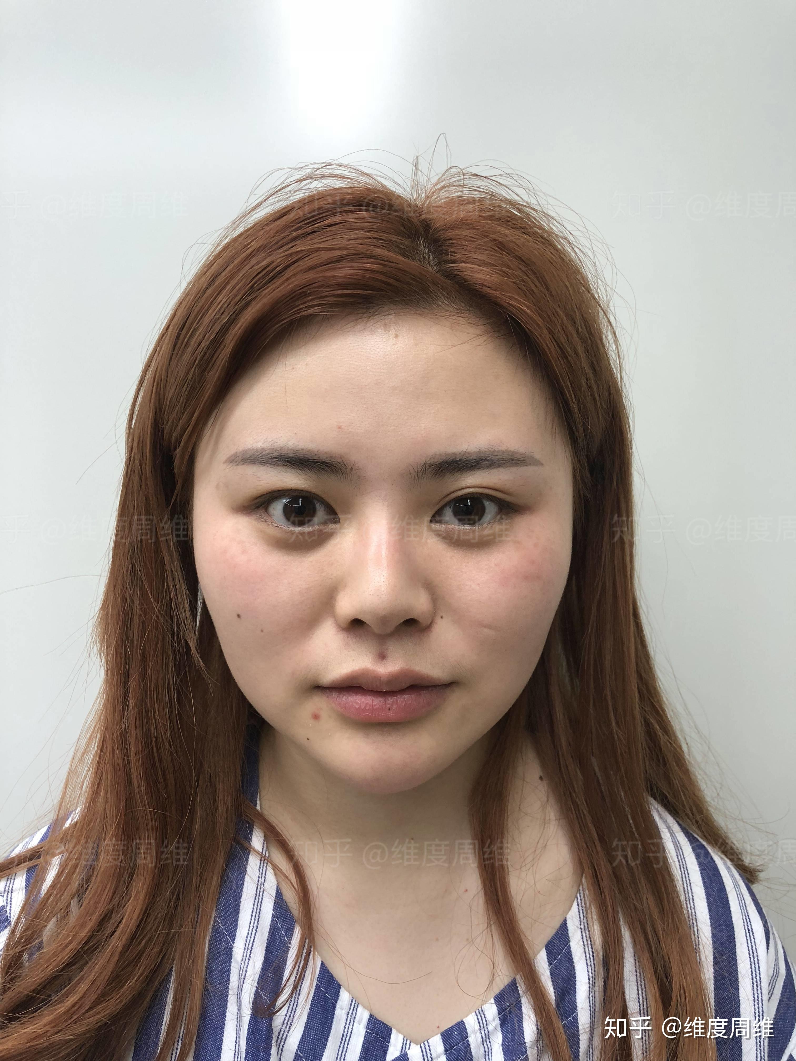 塌鼻梁是不是很低 v2-4c1663c8435a83f4266eeea73c8e5d94_r.jpg