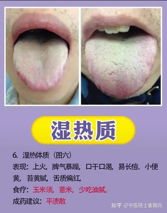 分享9种体质舌象，让老中医教你辨证，后面给你解决方法 - 知乎