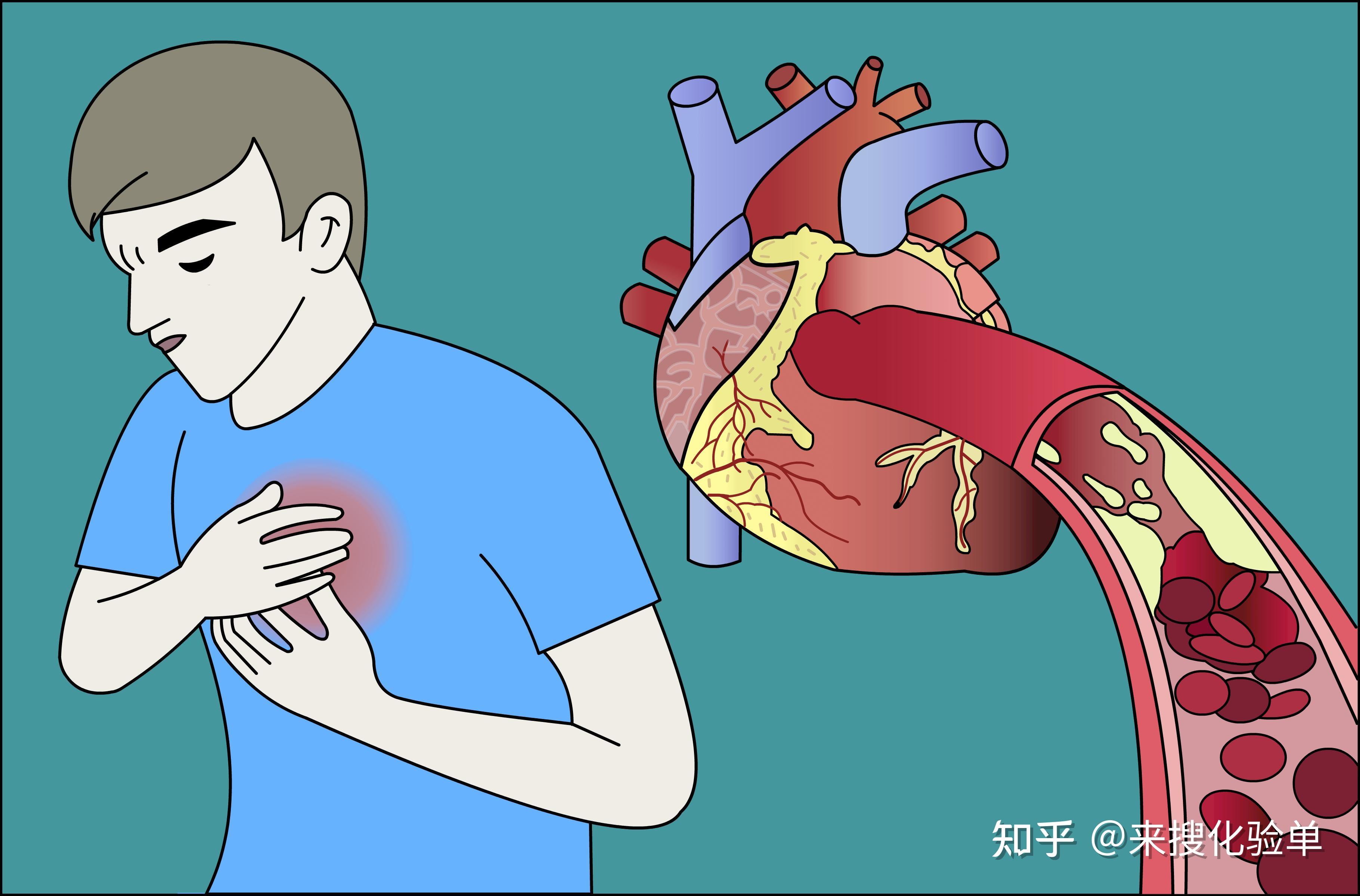 心肌缺血怎么检查？这些方法最常用_心电图