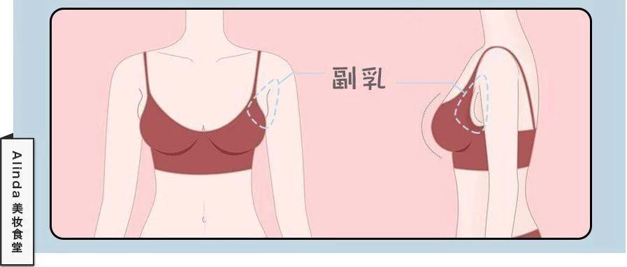 有 副乳 到底该怎么办 知乎 有 副乳 到底该怎么办 知乎