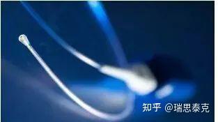 《胃食管反流病里昂共识》更新点解读 - 知乎