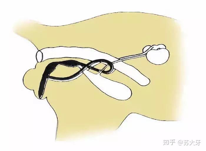 图解公猫绝育全过程