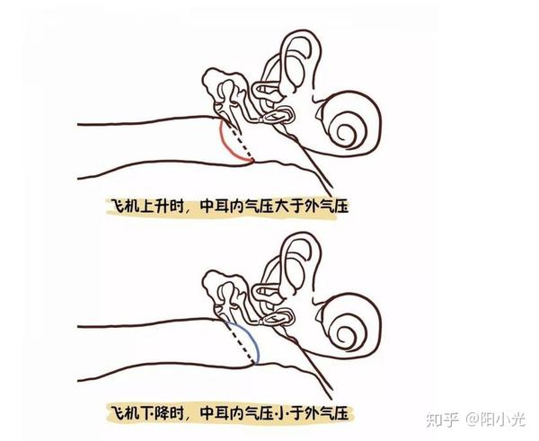 坐飞机可能会遇到这个问题一定要注意保护耳朵